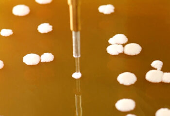 PIXL picking yeast