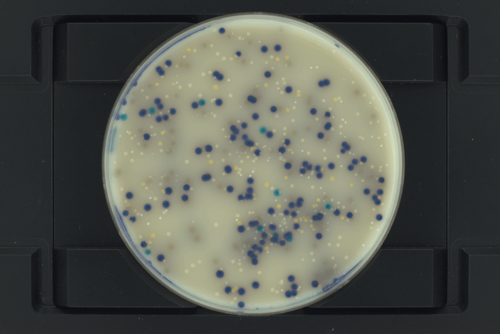 Brilliance UTI Clarity agar with colonies obtained from multi-drug resistant biofilms from tracheostomy tube