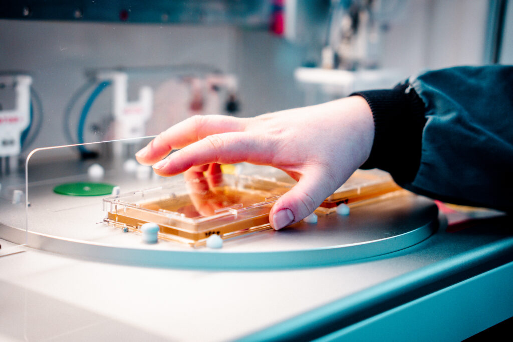 A hand picks up an SBS PlusPlate lid from an agar plate sitting on a bay of ROTOR+, a high-throughput screening robot. This is part of an antifungal screen. 